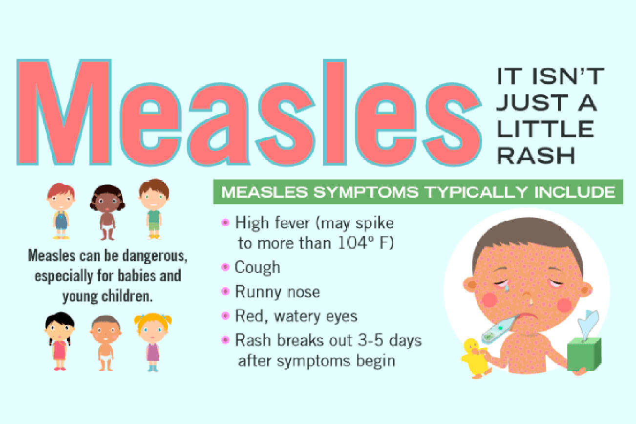 Images of adult onset of measles