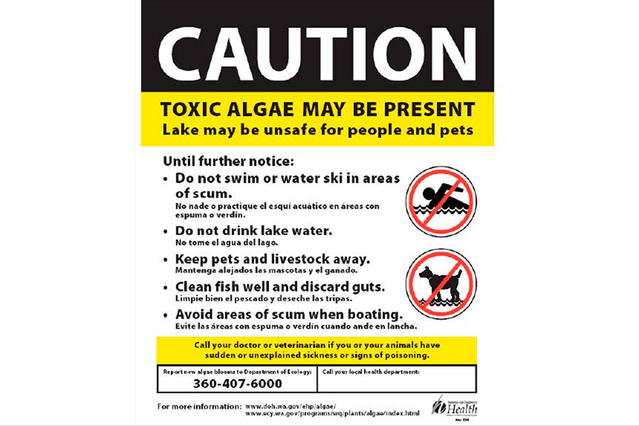 Health department warns of potential toxic algae